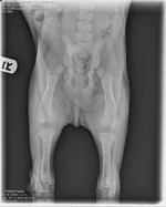 TrumanXray.webp