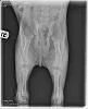 TrumanXray.webp