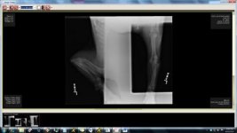 Xray - left2.jpg Xray - left2.jpg