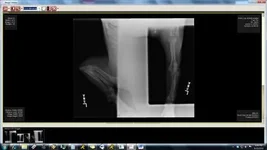 Xray - left2.webp