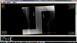 Xray - left.jpg Xray - left.jpg
