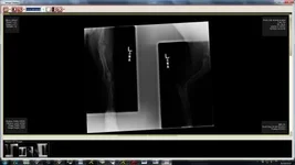 Xray - left.webp