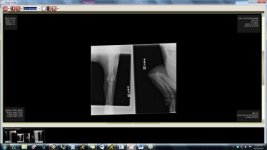 Xray - right.jpg Xray - right.jpg