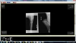 Xray - right.webp