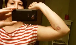 battlewounds.webp
