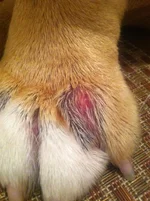 cyst.webp