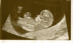 03052012 ultrasound 3.jpg