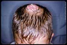 ringworm_s6.jpg ringworm_s6.jpg