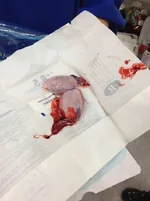 JJ After Surgery3.webp