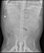 5.1 - ABDOMEN_VD.webp