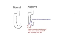AubreysWeirdIntestines.webp AubreysWeirdIntestines.webp