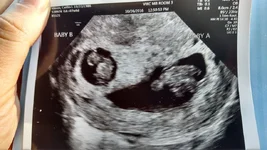 The twins first pic.webp