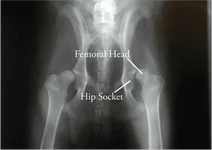 Hip-dysplasia-client-X-ray-1.webp Hip-dysplasia-client-X-ray-1.webp