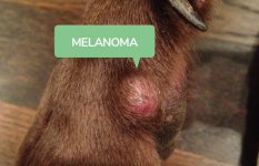 Melanoma-DNM-1.jpg