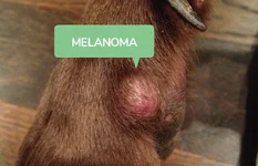 Melanoma-DNM-1.webp Melanoma-DNM-1.webp