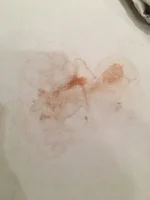 stain.webp