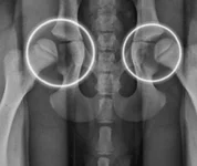 Hips1.webp