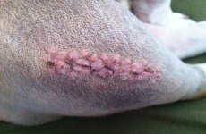 6-1-12-stitches-out.jpg