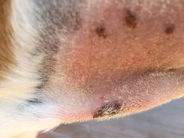 Dermatitis